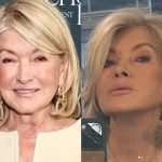 Martha Stewart Plastic Surgery Procedures