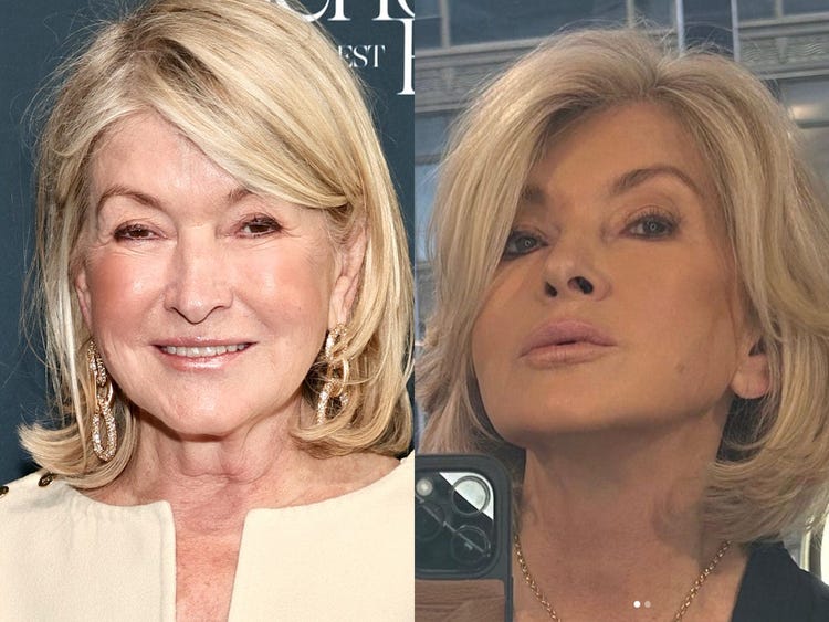 Martha Stewart Plastic Surgery Procedures