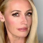 Cat Deeley Cosmetic Surgery
