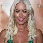 Denise van Outen Cosmetic Surgery