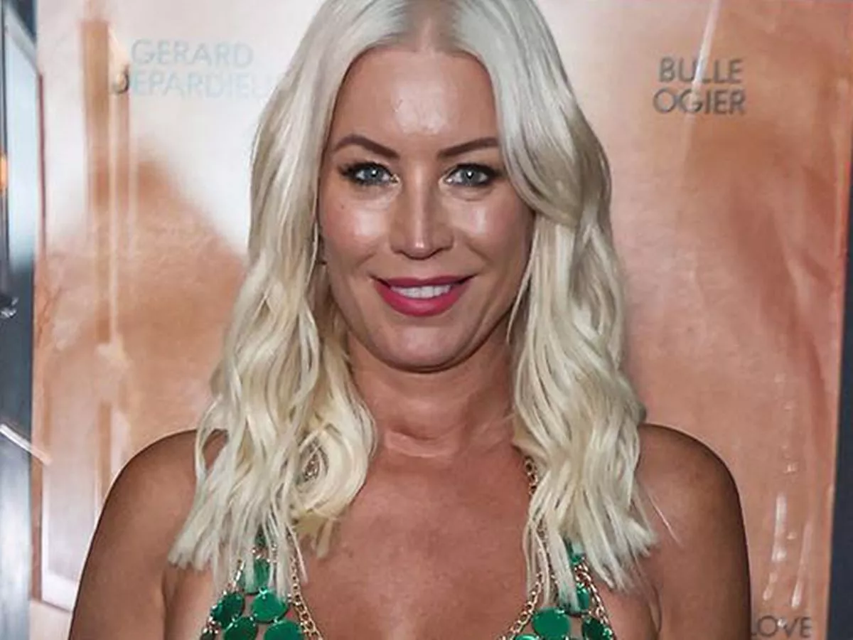 Denise van Outen Cosmetic Surgery