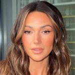 Michelle Keegan Plastic Surgery Procedures