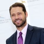 Jason Priestley Cosmetic Surgery