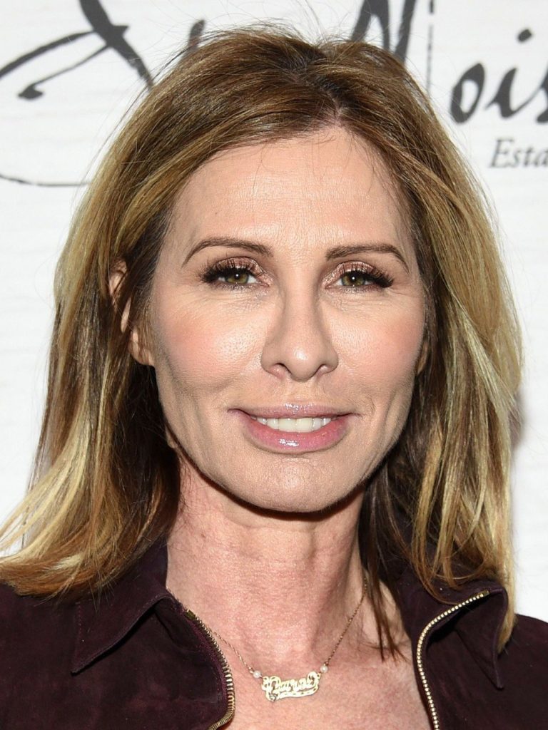 Carole Radziwill Plastic Surgery Face