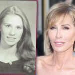 Carole Radziwill Plastic Surgery Procedures