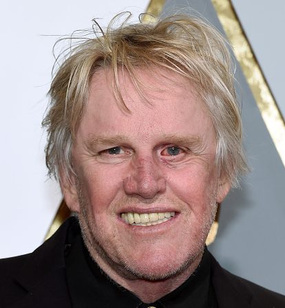 Gary Busey Cosmetic Surgery Face