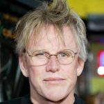 Gary Busey Plastic Surgery