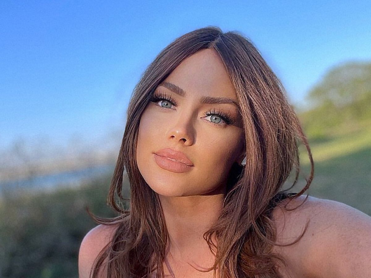 What Plastic Surgery Has Kathryn Dennis Had?