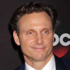 Tony Goldwyn Cosmetic Surgery Face