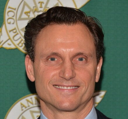 Tony Goldwyn Plastic Surgery Procedures