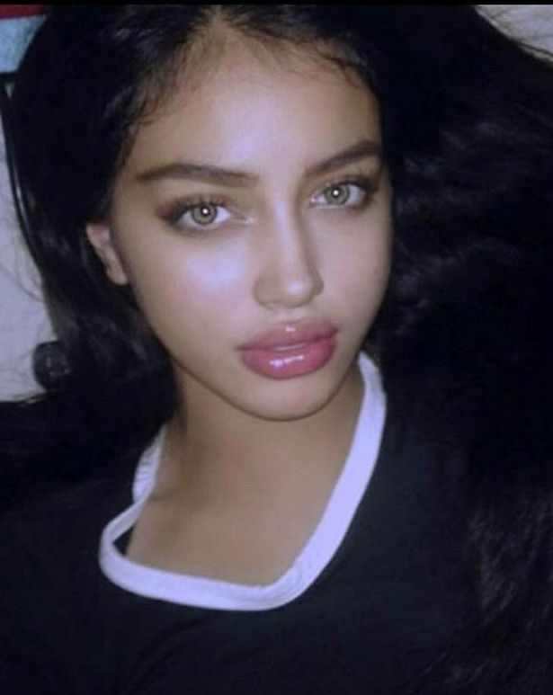 Cindy Kimberly Cosmetic Surgery Face