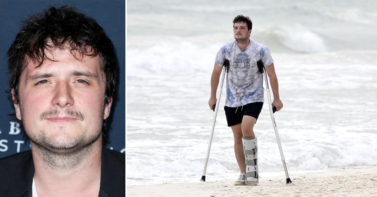 Did Josh Hutcherson Have Plastic Surgery? Everything You Need To Know!