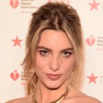 Lele Pons Cosmetic Surgery