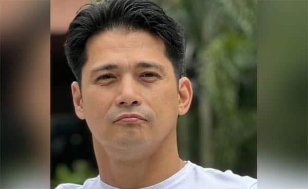 Robin Padilla Cosmetic Surgery Face