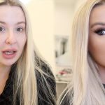 Tana Mongeau Botox, Fillers, and Lips