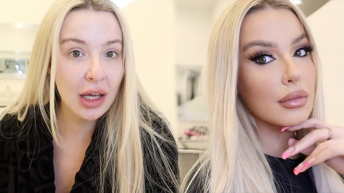 Tana Mongeau Botox, Fillers, and Lips