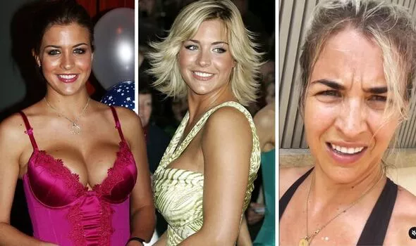 Gemma Atkinson Embraces Natural Beauty Despite Plastic Surgery Speculation