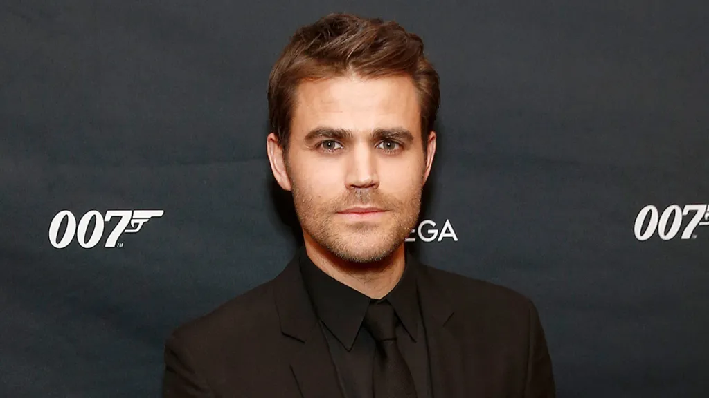 Paul Wesley’s Speculated Plastic Surgery: Cheek and Neck Changes Explored